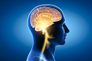 Headaches and migraines